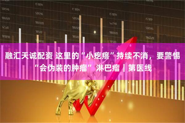 融汇天诚配资 这里的“小疙瘩”持续不消，要警惕“会伪装的肿瘤” 淋巴瘤｜第医线